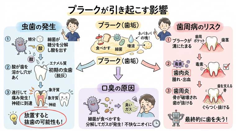 プラークが引き起こす影響の図解