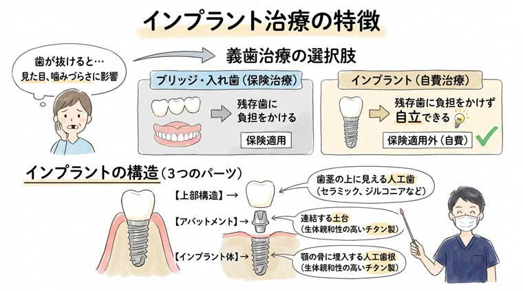 インプラント治療の特徴の図解