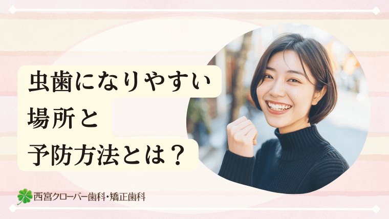 虫歯になりやすい場所と予防方法とは？