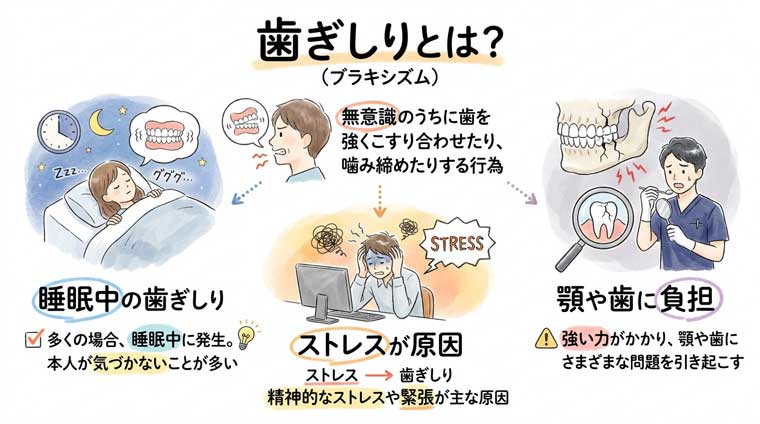 歯ぎしりとは？の図解