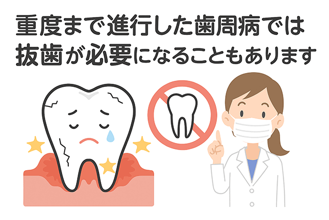 進行すると抜歯が必要になることもある