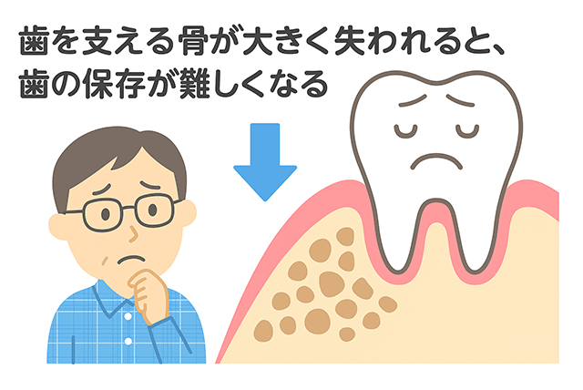 骨が失われると保存が難しくなる