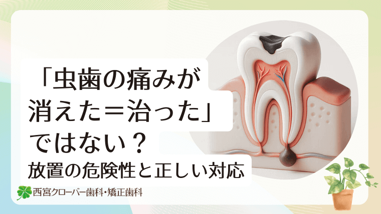 「虫歯の痛みが消えた=治った」ではない?