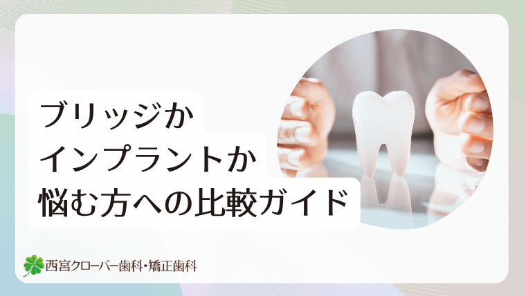 ブリッジかインプラントか悩む方への比較ガイド