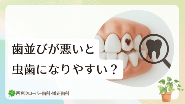歯並びが悪いと虫歯になりやすい？