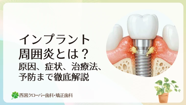 インプラント周囲炎とは？原因、症状、治療法、予防まで徹底解説
