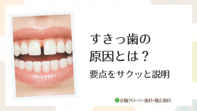 すきっ歯の原因とは？要点をサクッと説明