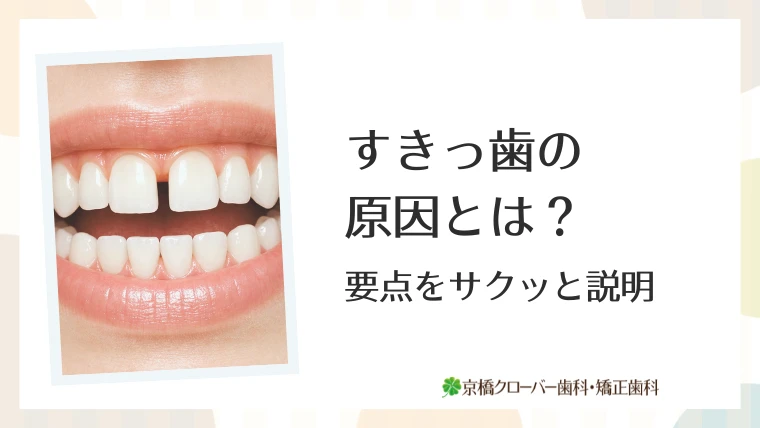 すきっ歯の原因とは？要点をサクッと説明