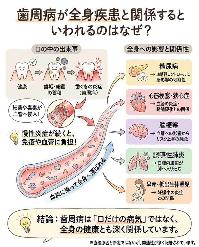 歯周病が全身疾患と関係するといわれるのはなぜ？の図解
