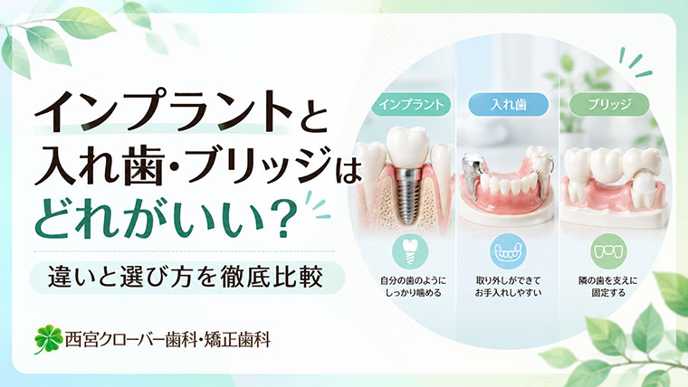 インプラントと入れ歯・ブリッジはどれがいい？違いと選び方を徹底比較