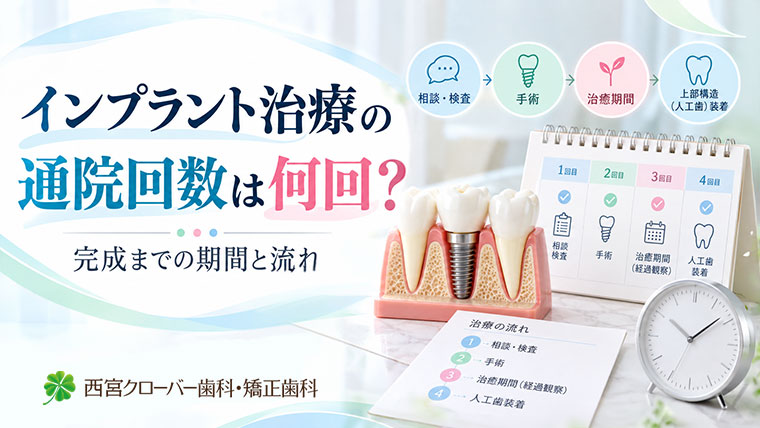 インプラント治療の通院回数は何回？完成までの期間と流れ